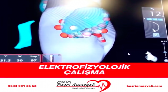 Kardiyoloji Uzmanı Prof. Dr. Basri Amasyalı'dan, 'Elektrofizyolojik çalışma' hakkında