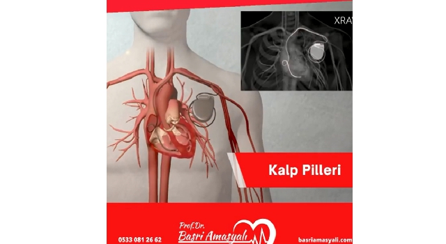 Kardiyoloji Uzmanı Prof. Dr. Basri Amasyalı'dan, 'Kalp Pilleri' hakkında önemli açıklamalar