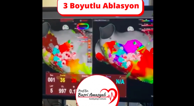 Kardiyoloji Uzmanı Prof. Dr. Basri Amasyalı'dan '3 boyutlu ablasyon tedavisi'