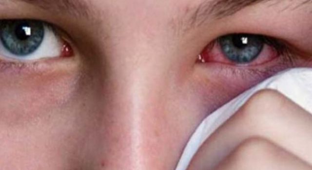 Prof. Dr. Yiğit'ten kritik 'adenovirüs' uyarısı