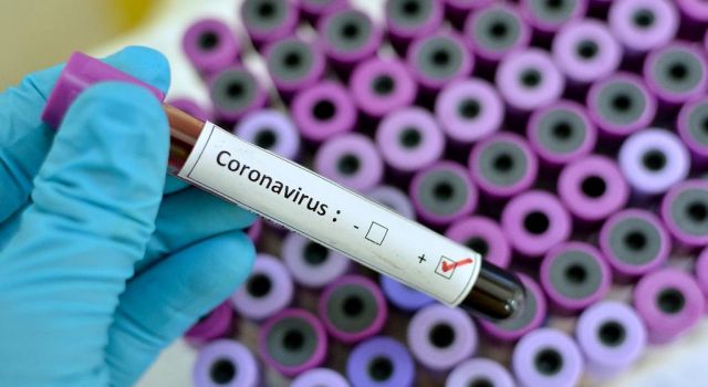 Koronavirüsün yeni belirtisi olduğu düşünülüyor!