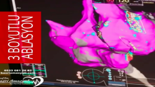 Kardiyoloji Uzmanı Prof. Dr. Basri Amasyalı, '3 boyutlu ablasyon' hakkında konuştu