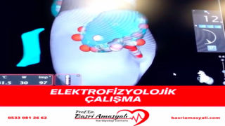 Kardiyoloji Uzmanı Prof. Dr. Basri Amasyalı'dan, 'Elektrofizyolojik çalışma' hakkında