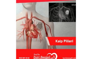 Kardiyoloji Uzmanı Prof. Dr. Basri Amasyalı'dan, 'Kalp Pilleri' hakkında önemli açıklamalar