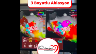 Kardiyoloji Uzmanı Prof. Dr. Basri Amasyalı'dan '3 boyutlu ablasyon tedavisi'