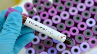 Koronavirüsün yeni belirtisi olduğu düşünülüyor!
