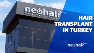 Neo Hair Plus ile Saç Ekiminde Güncel Teknoloji